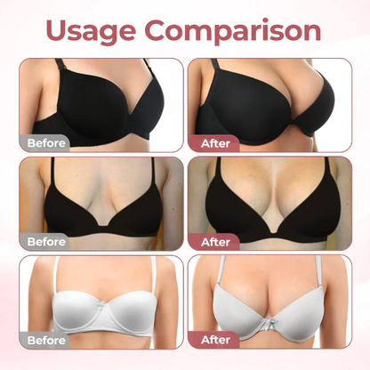 ❣️HISKIN® BREAST ENHANCEMENT  LIFT & FIRM MICRONEEDLE PATCHES