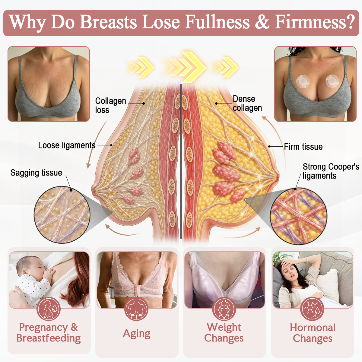 ❣️HISKIN® BREAST ENHANCEMENT  LIFT & FIRM MICRONEEDLE PATCHES