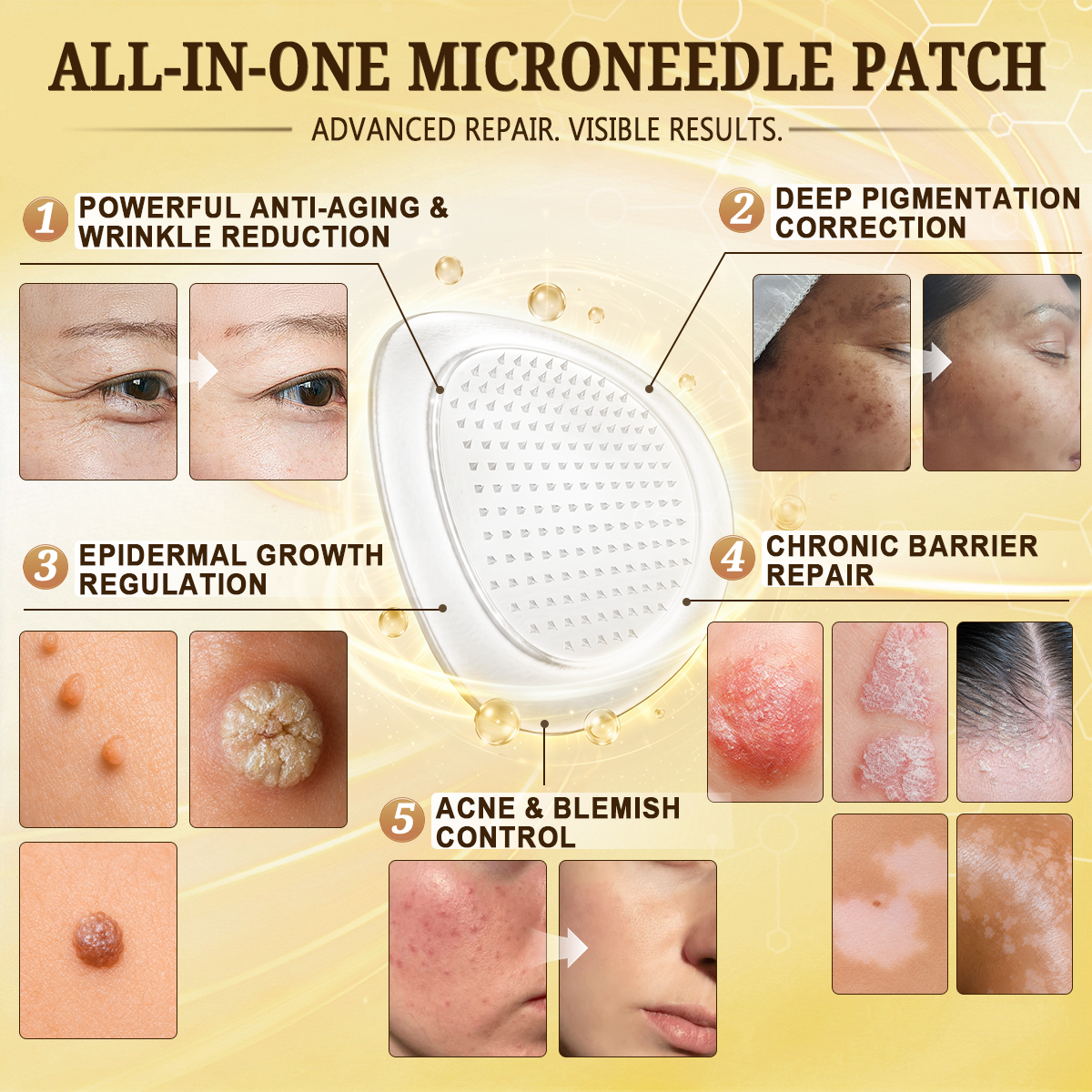 💜Hiskin ®MULTI-CONCERN SKIN REPAIR BEE VENOM MICRONEEDLE PATCHES