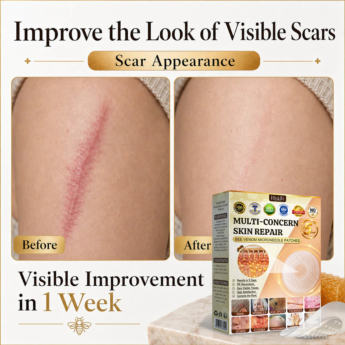 💜Hiskin ®MULTI-CONCERN SKIN REPAIR BEE VENOM MICRONEEDLE PATCHES