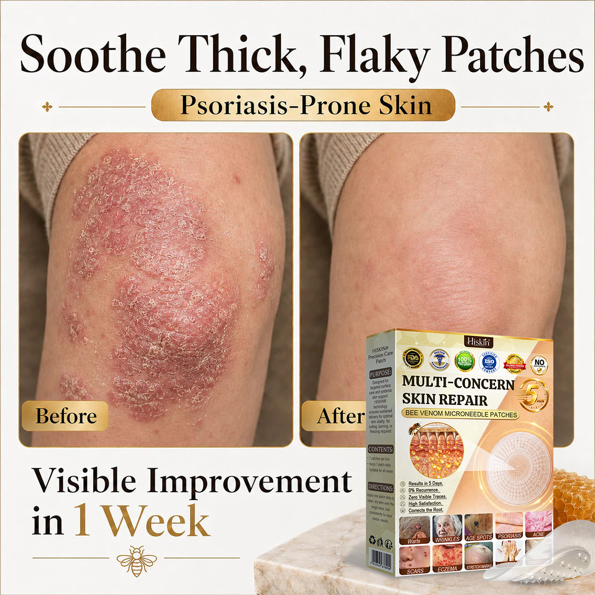 💜Hiskin ®MULTI-CONCERN SKIN REPAIR BEE VENOM MICRONEEDLE PATCHES