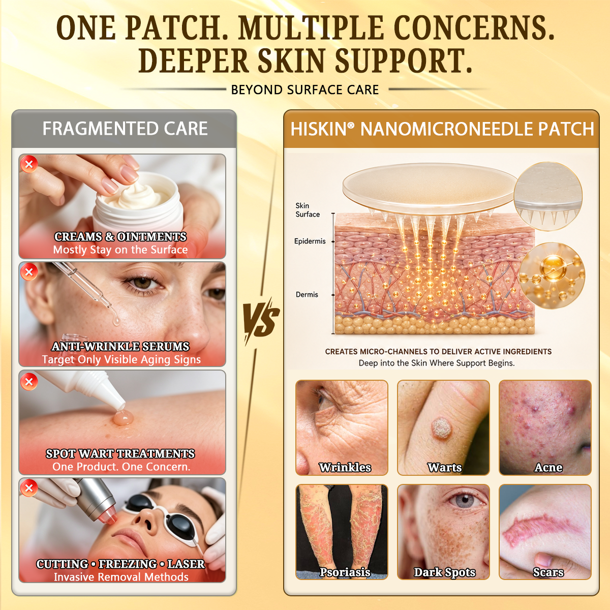 💜Hiskin ®MULTI-CONCERN SKIN REPAIR BEE VENOM MICRONEEDLE PATCHES