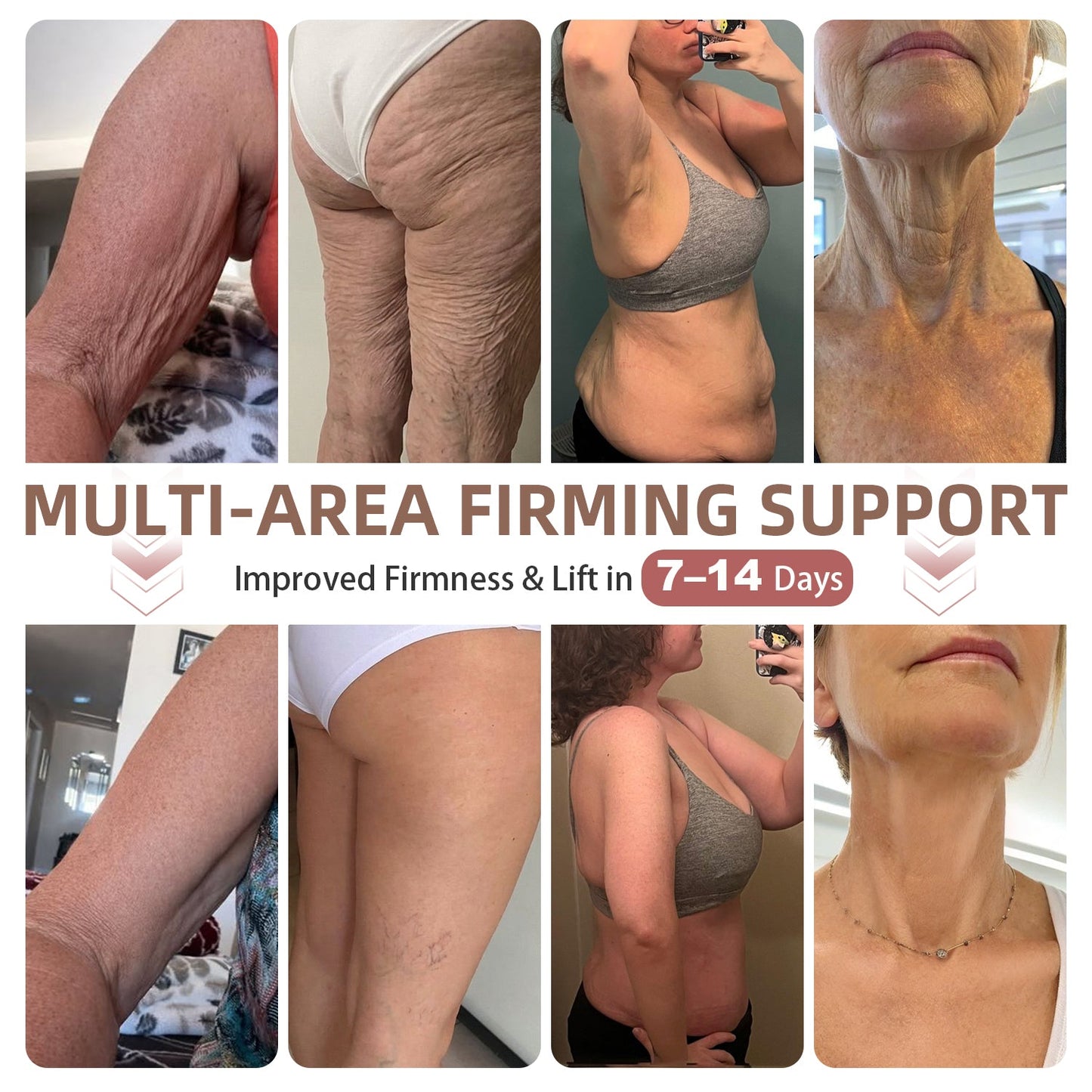 ❣️HISKIN® BREAST ENHANCEMENT  LIFT & FIRM MICRONEEDLE PATCHES