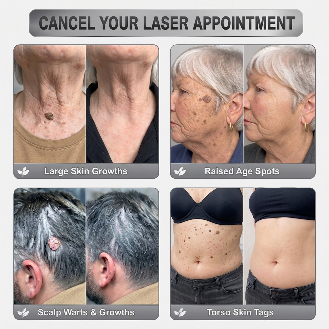 NEW 𝖧𝖨𝖲𝖪𝖨𝖭®👩‍⚕️⭐ 𝟕-𝐃𝒂𝘆 𝐒𝗸𝐢𝐧 𝐓𝒂𝗴 & 𝐒𝐩𝙤𝐭 𝐄𝐫𝒂𝐬𝙚𝐫 Painless & Scar-Free Advanced Imperfection Removal Rollerball Pen