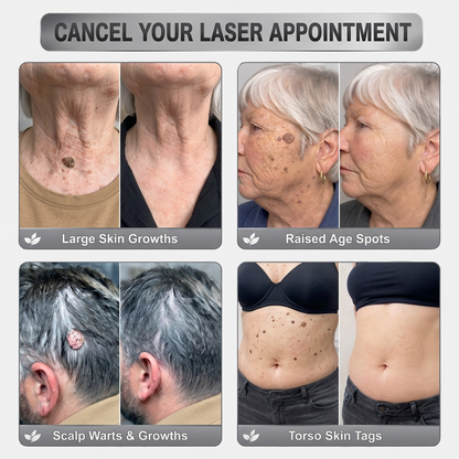 NEW 𝖧𝖨𝖲𝖪𝖨𝖭®👩‍⚕️⭐ 𝟕-𝐃𝒂𝘆 𝐒𝗸𝐢𝐧 𝐓𝒂𝗴 & 𝐒𝐩𝙤𝐭 𝐄𝐫𝒂𝐬𝙚𝐫 Painless & Scar-Free Advanced Imperfection Removal Rollerball Pen
