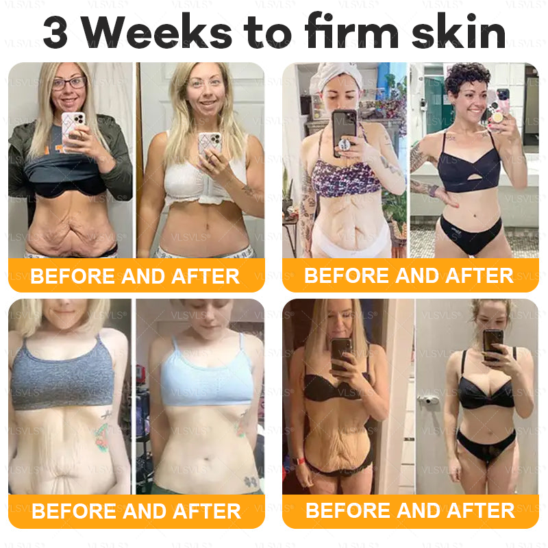 Made and Shipped from USA  🎉🎉🎉𝑽𝑳𝑺𝑽𝑳𝑺® Bee Venom Comprehensive Cream  LAST DAY 80% OFF(Sagging Skin, Fine Lines, Loss of Firmness, Flat Bust, Drooping Hips, and More)
