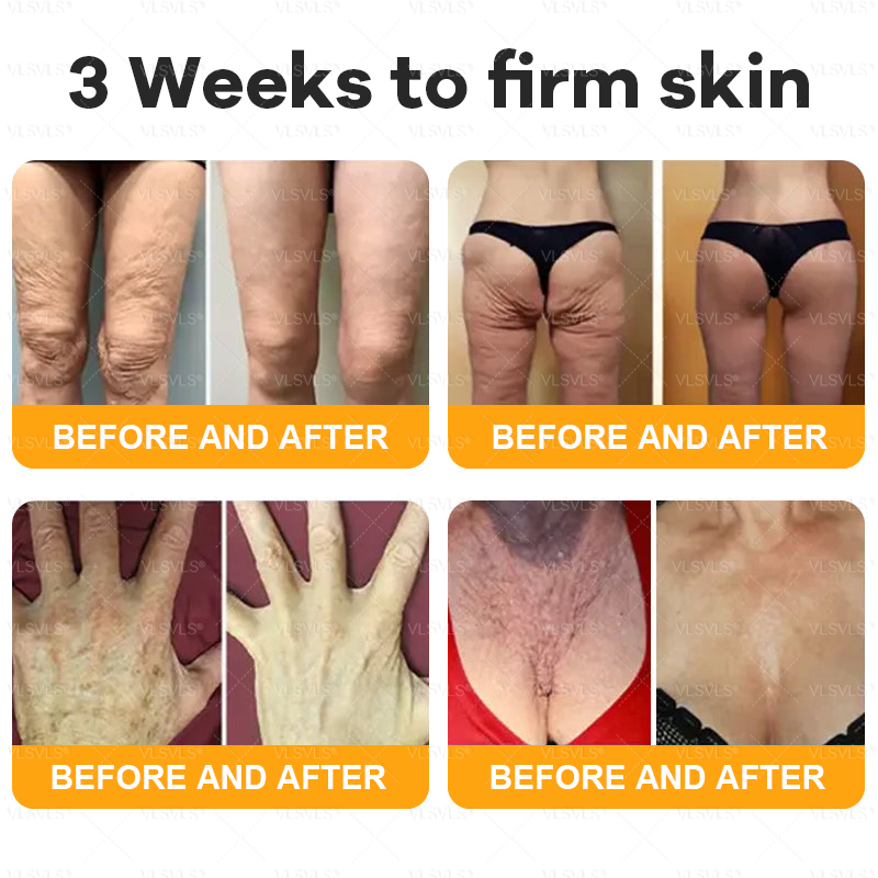 Made and Shipped from USA  🎉🎉🎉𝑽𝑳𝑺𝑽𝑳𝑺® Bee Venom Comprehensive Cream  LAST DAY 80% OFF(Sagging Skin, Fine Lines, Loss of Firmness, Flat Bust, Drooping Hips, and More)