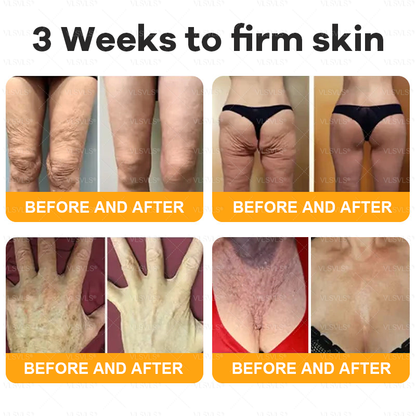 Made and Shipped from USA  🎉🎉🎉𝑽𝑳𝑺𝑽𝑳𝑺® Bee Venom Comprehensive Cream  LAST DAY 80% OFF(Sagging Skin, Fine Lines, Loss of Firmness, Flat Bust, Drooping Hips, and More)