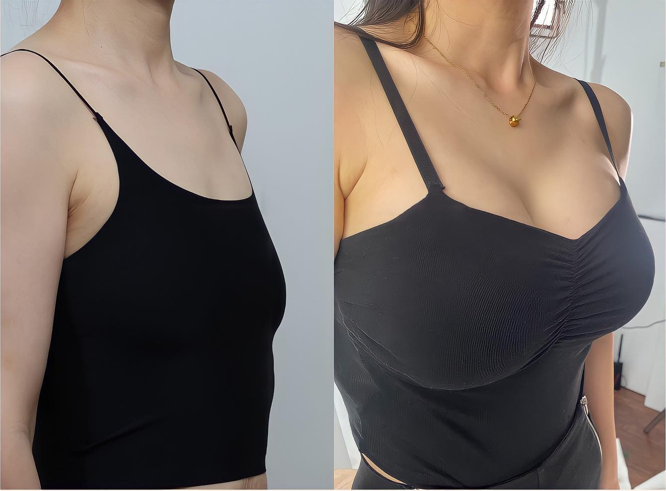 ❣️HISKIN® BREAST ENHANCEMENT  LIFT & FIRM MICRONEEDLE PATCHES