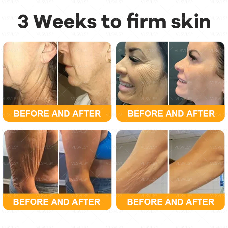 Made and Shipped from USA  🎉🎉🎉𝑽𝑳𝑺𝑽𝑳𝑺® Bee Venom Comprehensive Cream  LAST DAY 80% OFF(Sagging Skin, Fine Lines, Loss of Firmness, Flat Bust, Drooping Hips, and More)