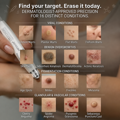 NEW 𝖧𝖨𝖲𝖪𝖨𝖭®👩‍⚕️⭐ 𝟕-𝐃𝒂𝘆 𝐒𝗸𝐢𝐧 𝐓𝒂𝗴 & 𝐒𝐩𝙤𝐭 𝐄𝐫𝒂𝐬𝙚𝐫 Painless & Scar-Free Advanced Imperfection Removal Rollerball Pen