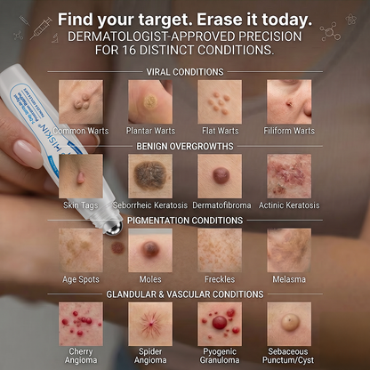 🔖𝖧𝖨𝖲𝖪𝖨𝖭®👩‍⚕️⭐ 𝟕-𝐃𝒂𝘆 𝐒𝗸𝐢𝐧 𝐓𝒂𝗴 & 𝐒𝐩𝙤𝐭 𝐄𝐫𝒂𝐬𝙚𝐫 Painless & Scar-Free Advanced Imperfection Removal Rollerball Pen