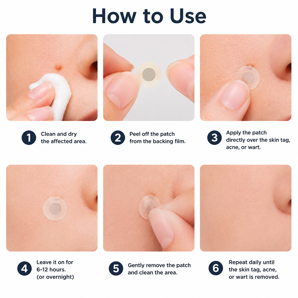 💝Hiskin ® 2-in-1 Microneedle & Hydrocolloid Patch🍀 | Removes raised moles, acne, flat warts, and skin tags | Helps improve wrinkles, scars, and blemishes | Invisible patches for face and body