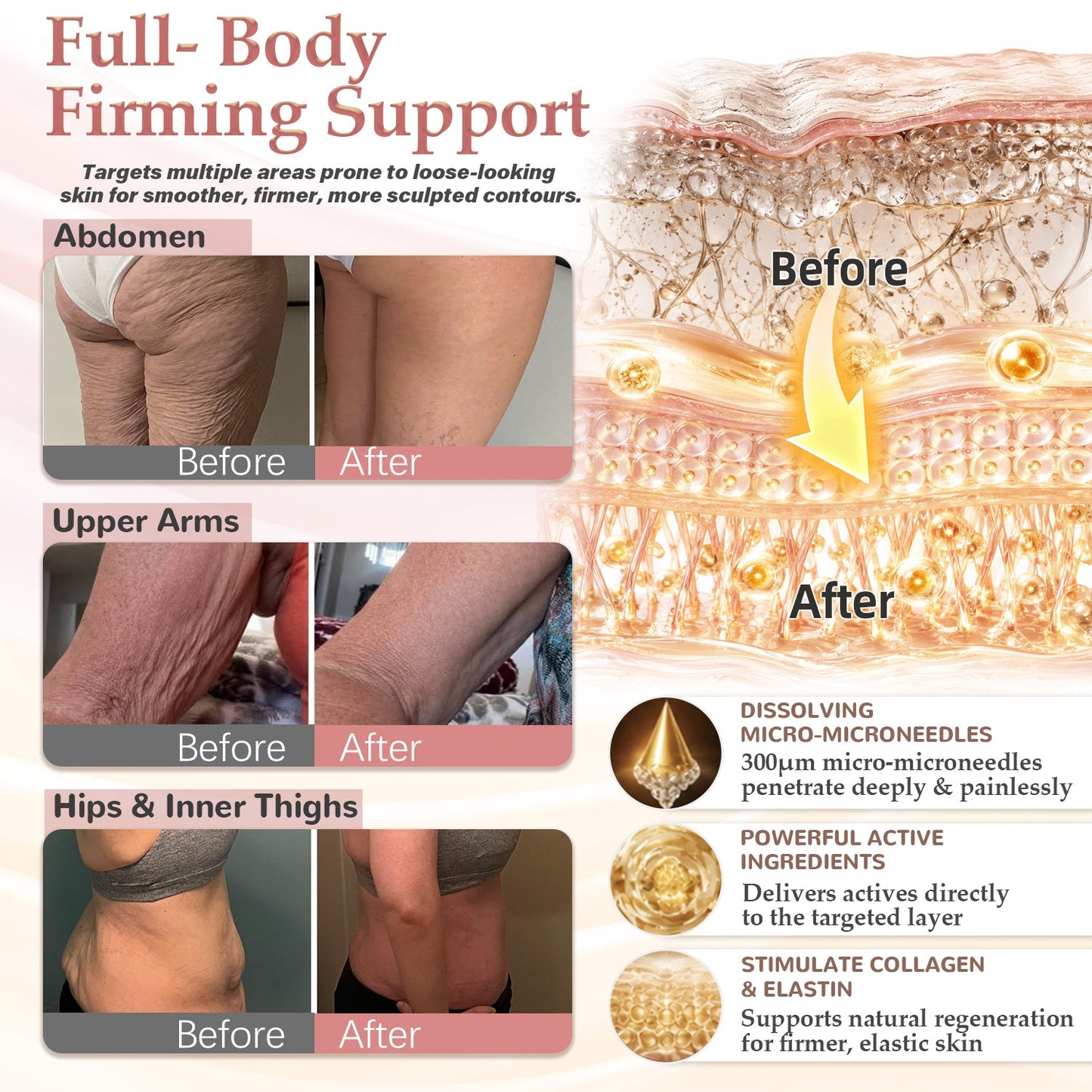 ❣️HISKIN® BREAST ENHANCEMENT  LIFT & FIRM MICRONEEDLE PATCHES