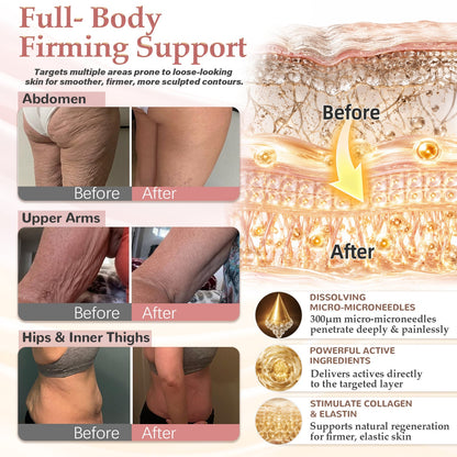 ❣️HISKIN® BREAST ENHANCEMENT  LIFT & FIRM MICRONEEDLE PATCHES